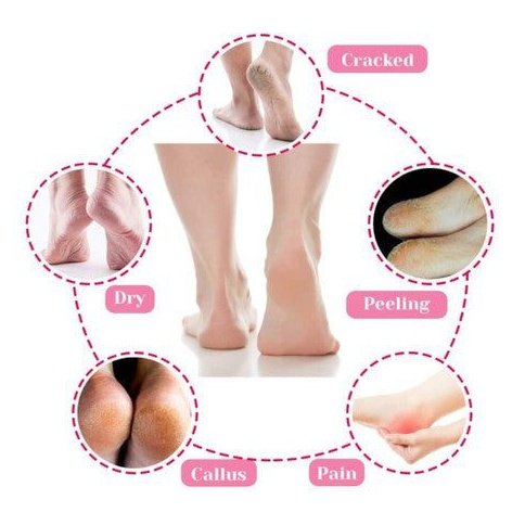 Calcetines hidratantes para talón